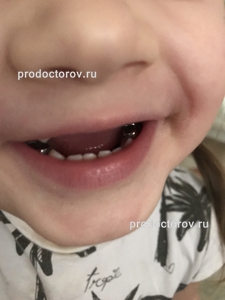 Краснодар лечение зубов под наркозом отзывы