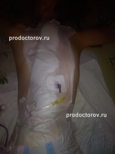 Елизарова в кургане лечение грыжи