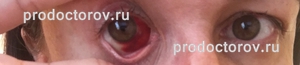 В тамбове лечение глаз отслоение сетчатки