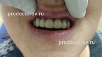 Форум лечение зубов в ульяновске