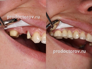 Форум лечение зубов в ульяновске