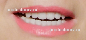 /
