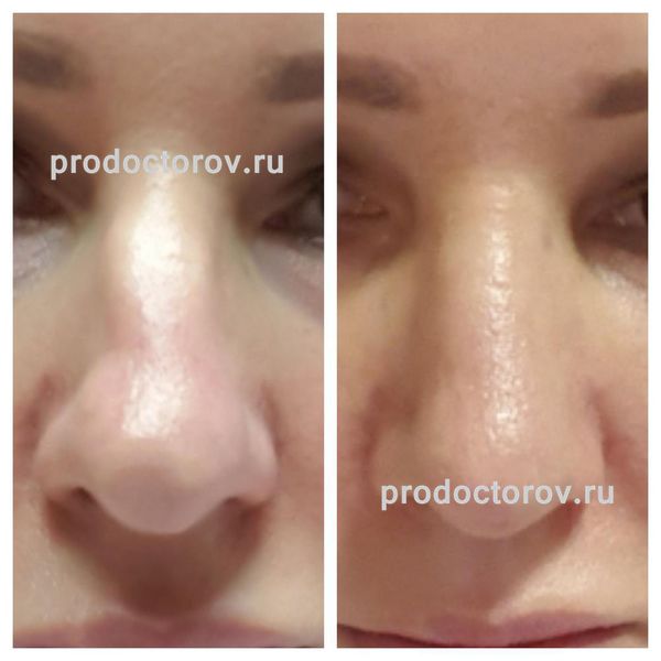 попугаев павел вадимович пластический. кулькеев алексей владимирович пластический хирург челябинск клиника. кулькеев пластический хирург. кулькеев пластический хирург. ринопластика кулькеев.