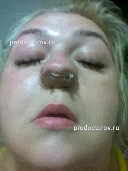 Савинков Анатолий Борисович, пластический хирург - 6 отзывов ...