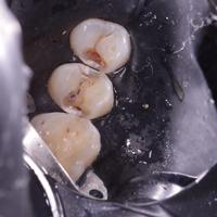 Пример работы до и после -