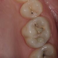 Пример работы до и после -