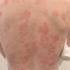 Пример работы до и после - 