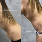 Пример работы до и после - 