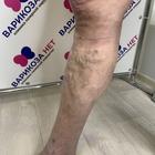 Пример работы до и после - 