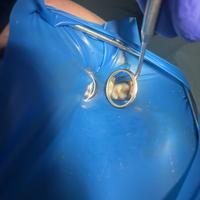 Пример работы до и после - 