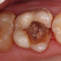 Пример работы до и после -