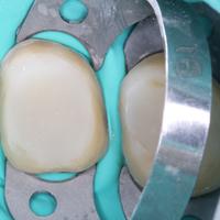 Пример работы до и после -