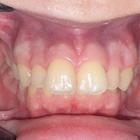 Пример работы до и после -