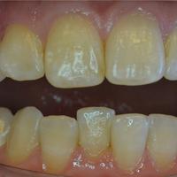 Пример работы до и после - 