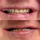 Пример работы до и после - 