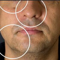 Пример работы до и после - 