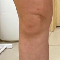 Пример работы до и после - 