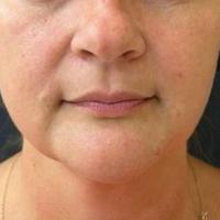 Пример работы до и после - 