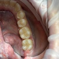 Пример работы до и после -