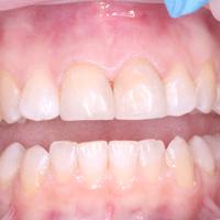 Пример работы до и после -