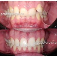 Пример работы до и после -