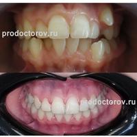 Пример работы до и после -