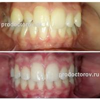 Пример работы до и после -