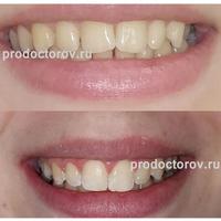 Пример работы до и после -