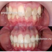 Пример работы до и после -