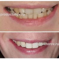 Пример работы до и после -