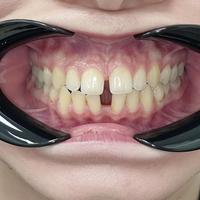 Пример работы до и после -