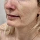 Пример работы до и после - 