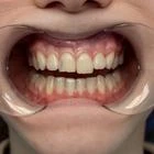 Пример работы до и после - 