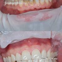 Пример работы до и после -