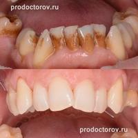 Пример работы до и после -