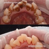 Пример работы до и после -