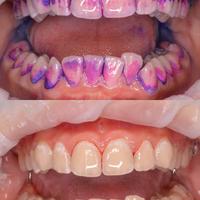 Пример работы до и после -