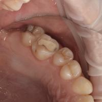 Пример работы до и после -