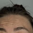 Пример работы до и после - 