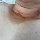 Пример работы до и после - 