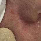 Пример работы до и после - 