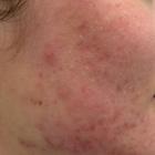 Пример работы до и после - 