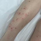 Пример работы до и после - 