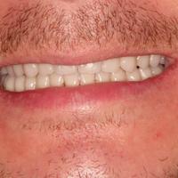 Пример работы до и после - 