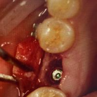 Пример работы до и после - 