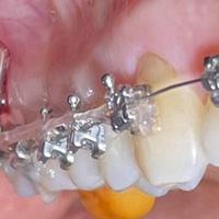 Пример работы до и после - 