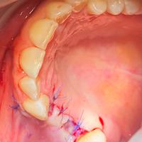 Пример работы до и после - 