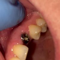 Пример работы до и после - 