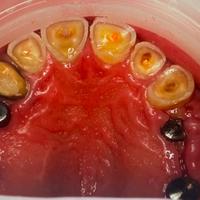 Пример работы до и после - 