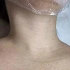 Пример работы до и после -